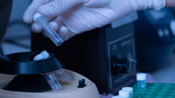 Reactivos PCR punto final y Tiempo Real